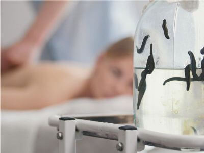 زالو طبی گیرای مدیسینالیس و اورینتالیس برای زالودرمانی در تهران