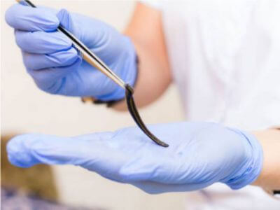 خرید زالوطبی در تهران